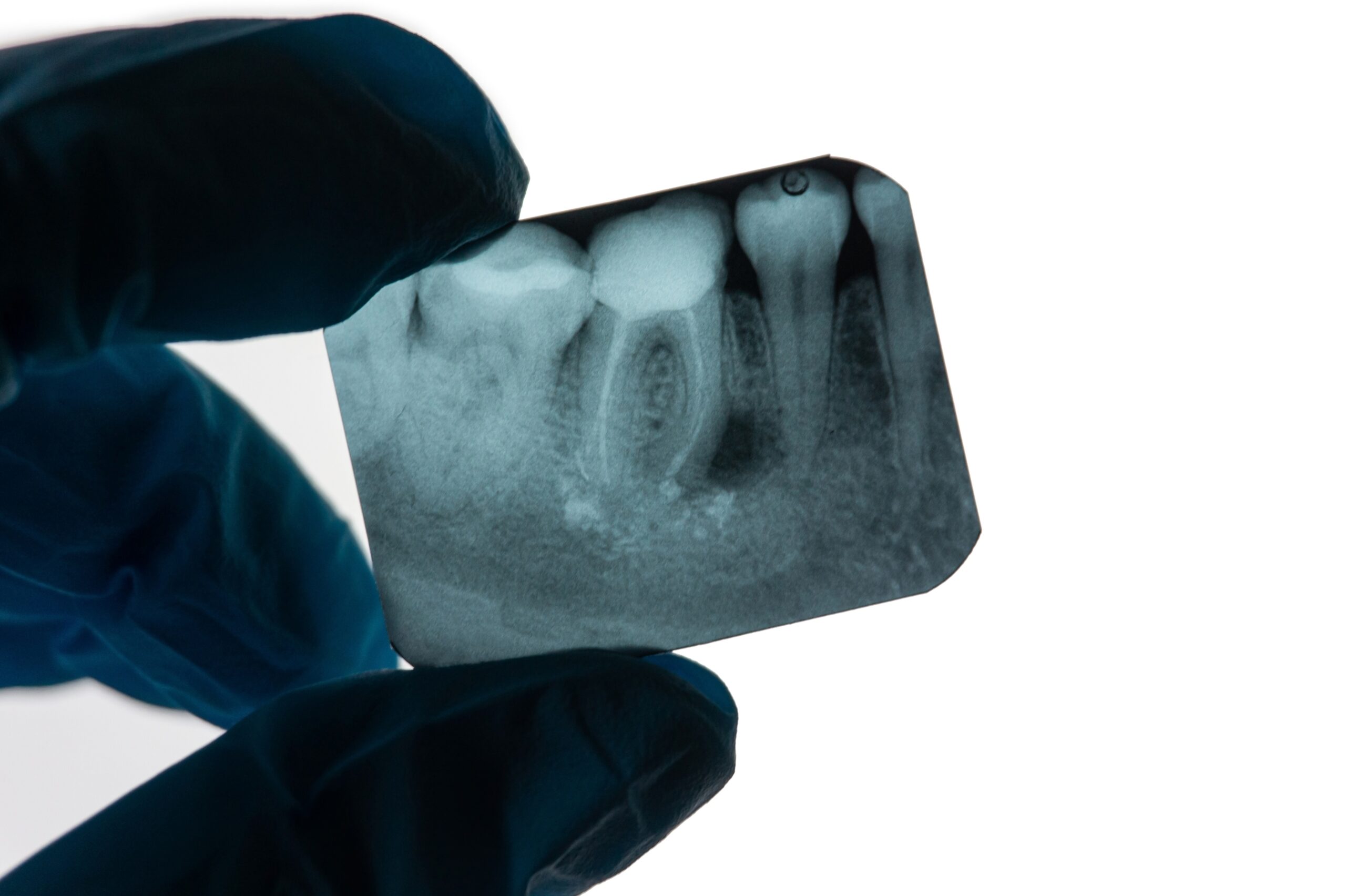 https://www.docteur-bioteau.fr/wp-content/uploads/2023/03/shutterstock_2227862837-scaled.jpg