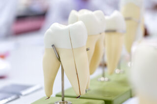 https://www.docteur-bioteau.fr/wp-content/uploads/2023/05/shutterstock_1024412242-320x213.jpg